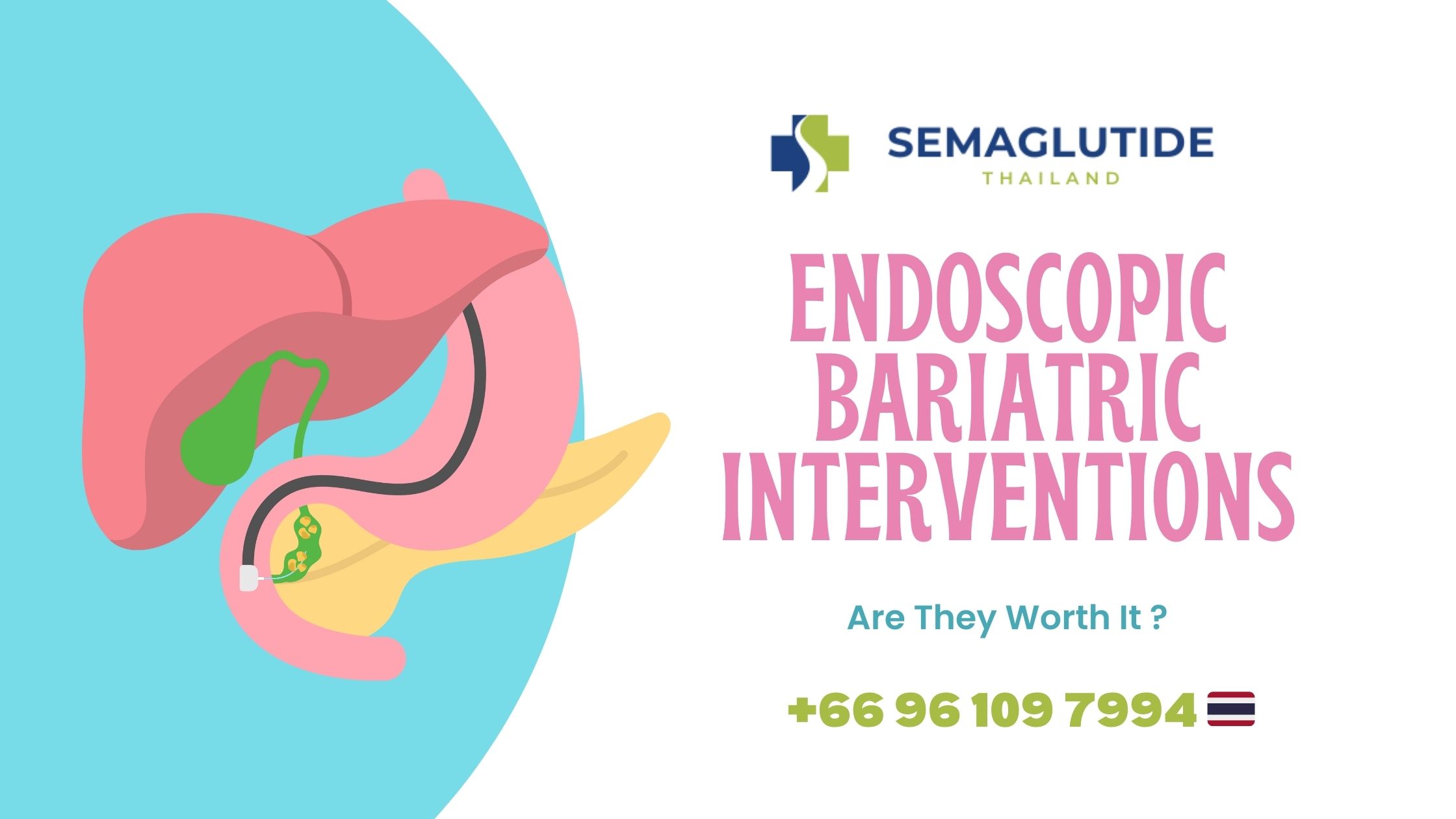 Endoscopic Bariatric Interventions: Are They Worth It?